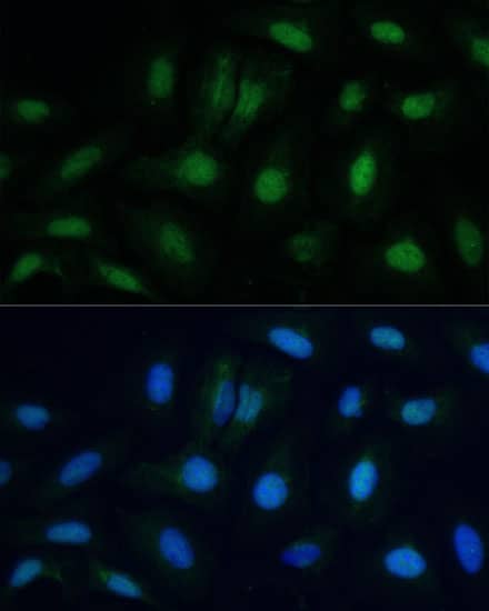 ETS2 Antibody - Azide and BSA Free