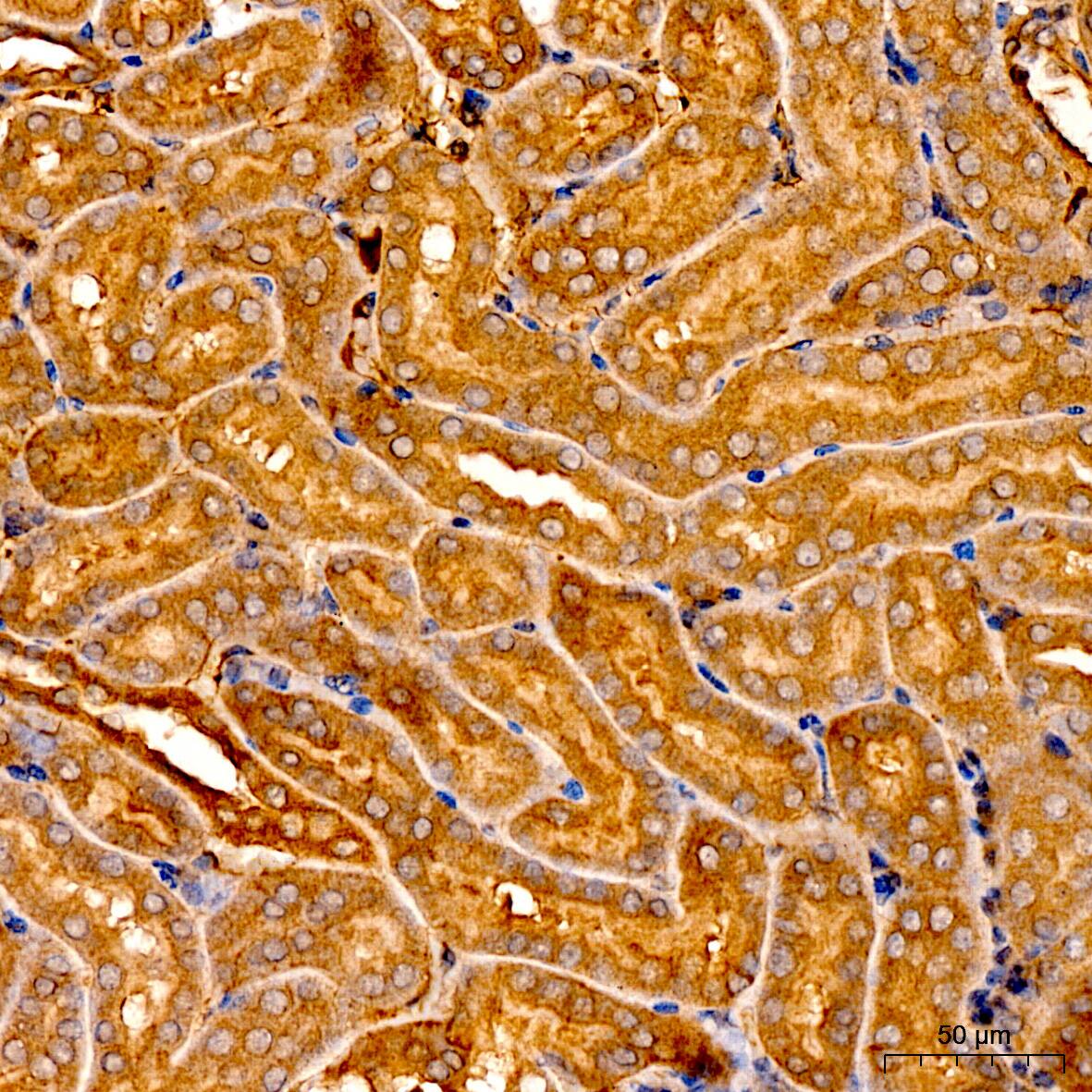 LPCAT3 Antibody - Azide and BSA Free