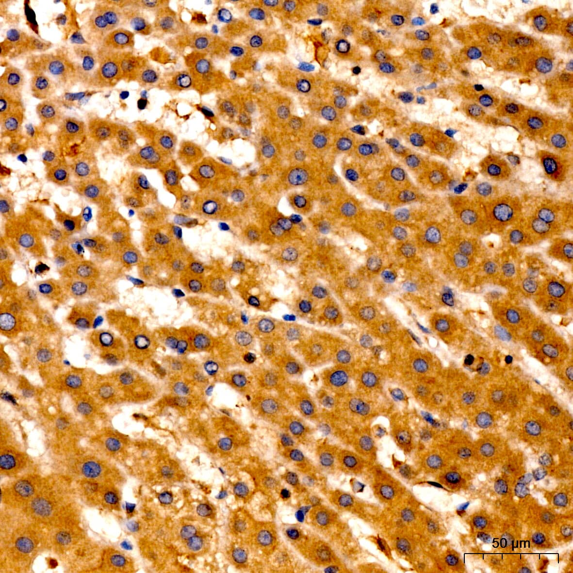 LPCAT3 Antibody - Azide and BSA Free