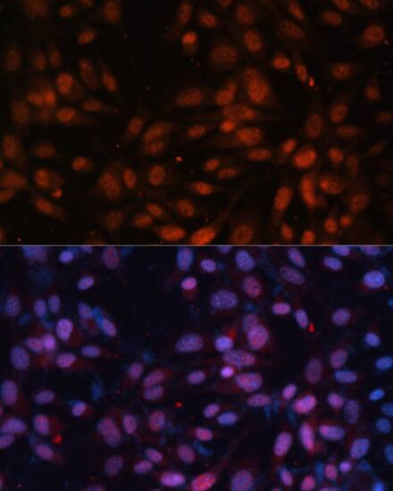ZNF574 Antibody - Azide and BSA Free