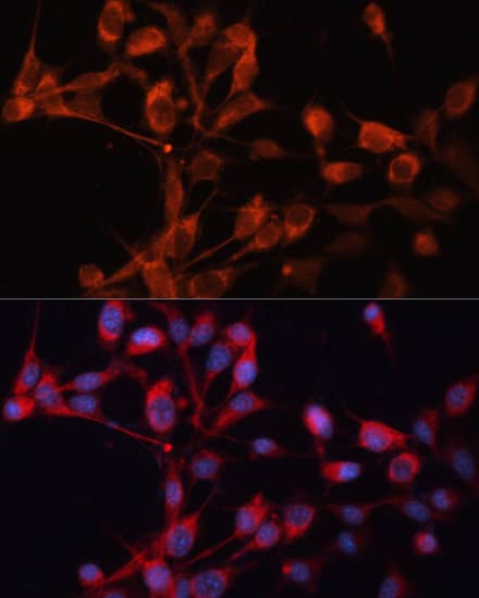 SLC25A19 Antibody - Azide and BSA Free