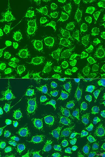 GYPB Antibody - BSA Free
