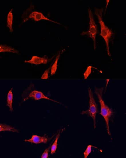 DNASE1 Antibody - Azide and BSA Free