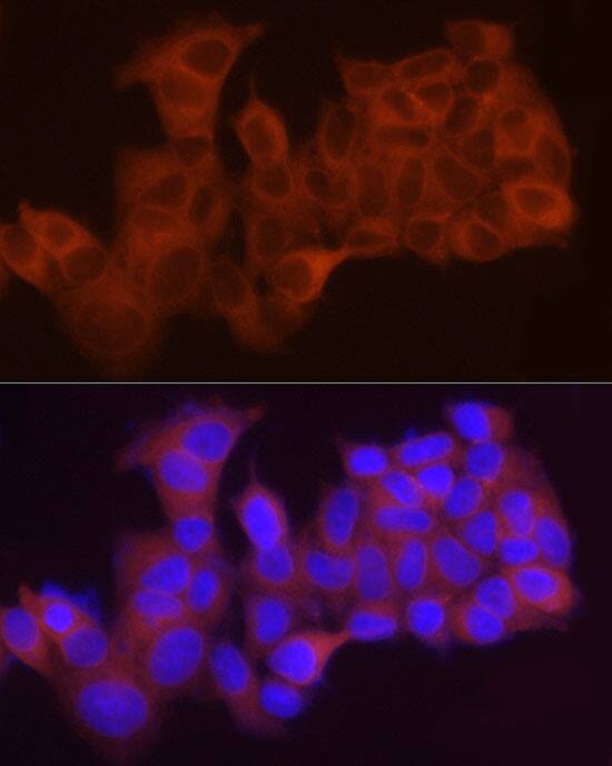 LPCAT1 Antibody - BSA Free