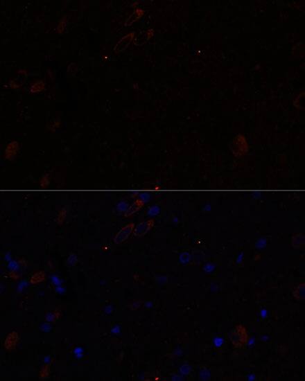 KIF17 Antibody - Azide and BSA Free