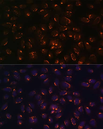 GALNT2 Antibody - BSA Free