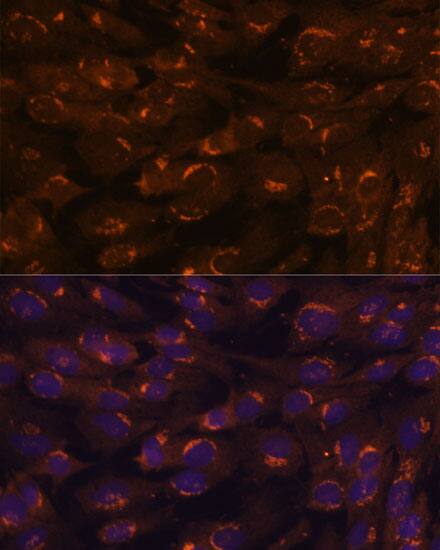 GALNT2 Antibody - BSA Free