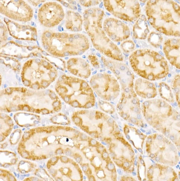 GALNT2 Antibody - BSA Free