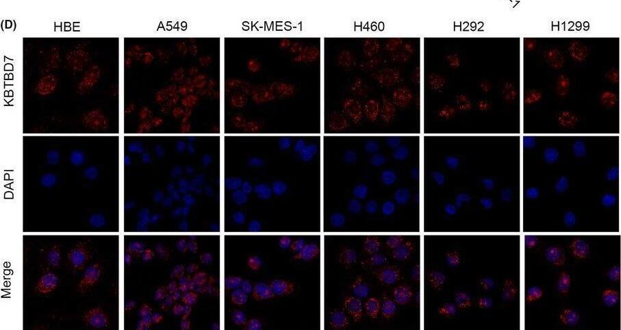 KBTBD7 Antibody - BSA Free