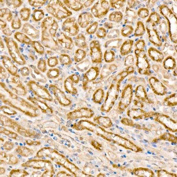 MCCC1 Antibody - BSA Free