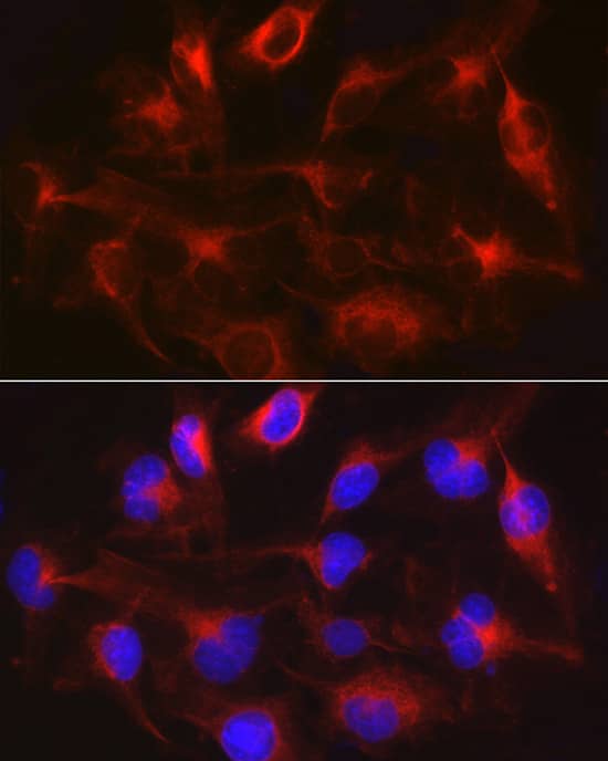 METTL7B Antibody - Azide and BSA Free