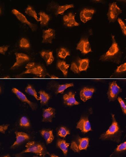OBSCN Antibody - Azide and BSA Free