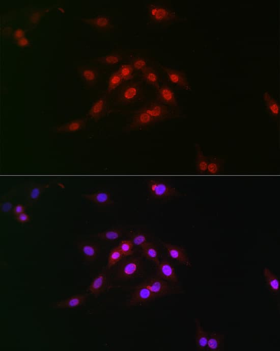 Cyclin E1 [p Thr395] Antibody - BSA Free