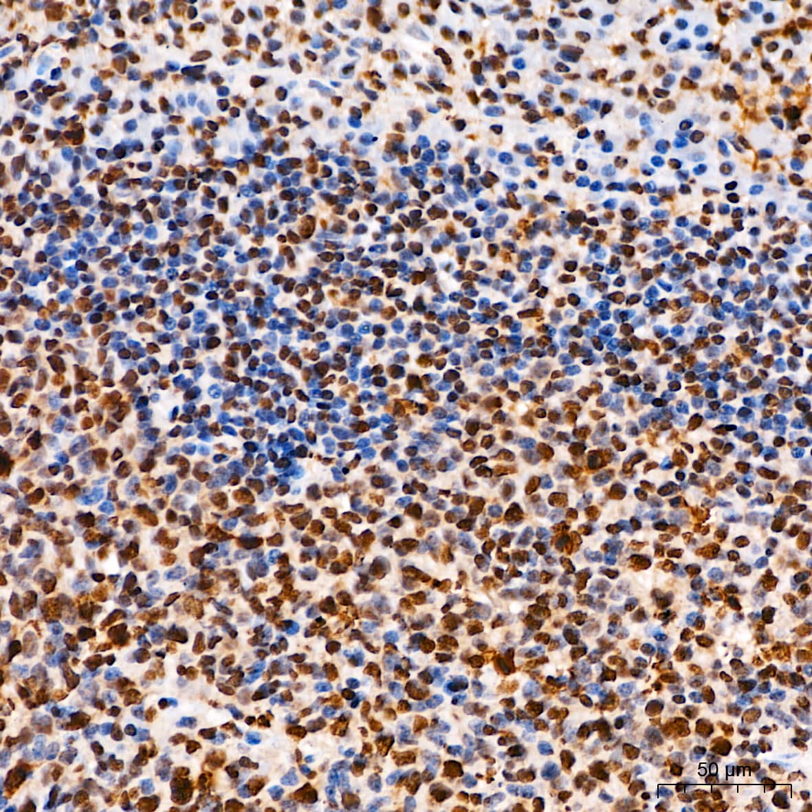 Elk-1 [p Ser383] Antibody - BSA Free