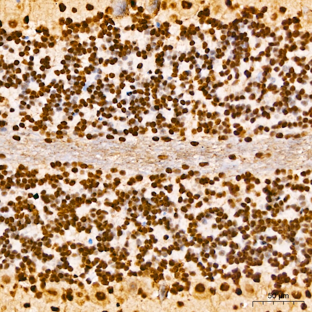 Elk-1 [p Ser383] Antibody - BSA Free