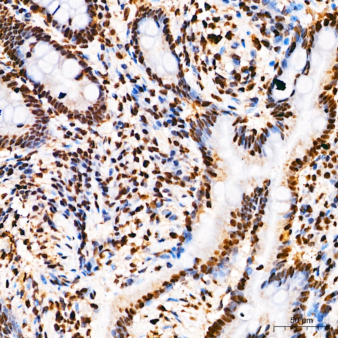 Elk-1 [p Ser383] Antibody - BSA Free