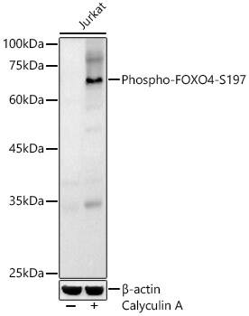 FOXO4 [p Ser197] Antibody - Azide and BSA Free