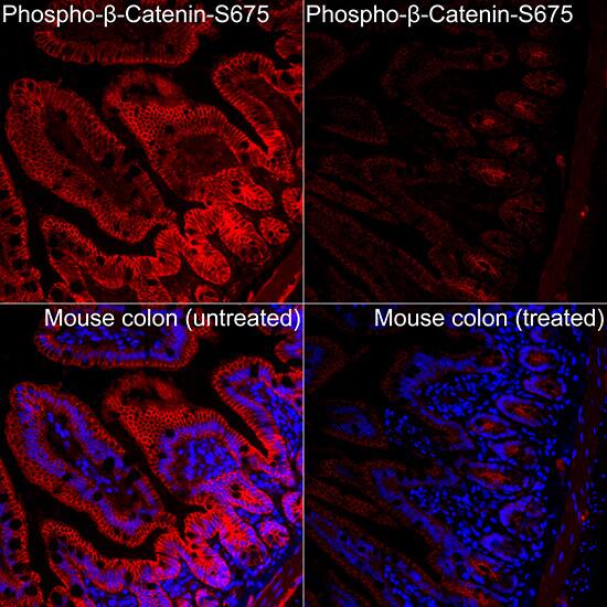 beta-Catenin [p Ser675] Antibody - Azide and BSA Free
