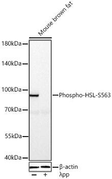 Hormone-sensitive Lipase/HSL [p Ser563] Antibody - Azide and BSA Free