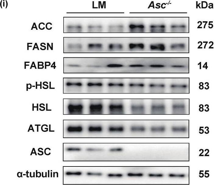 Hormone-sensitive Lipase/HSL [p Ser660] Antibody - Azide and BSA Free
