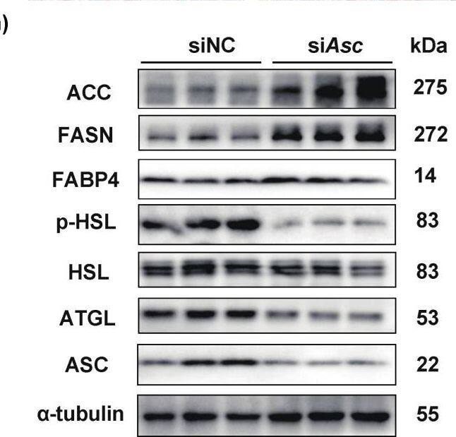 Hormone-sensitive Lipase/HSL [p Ser660] Antibody - Azide and BSA Free