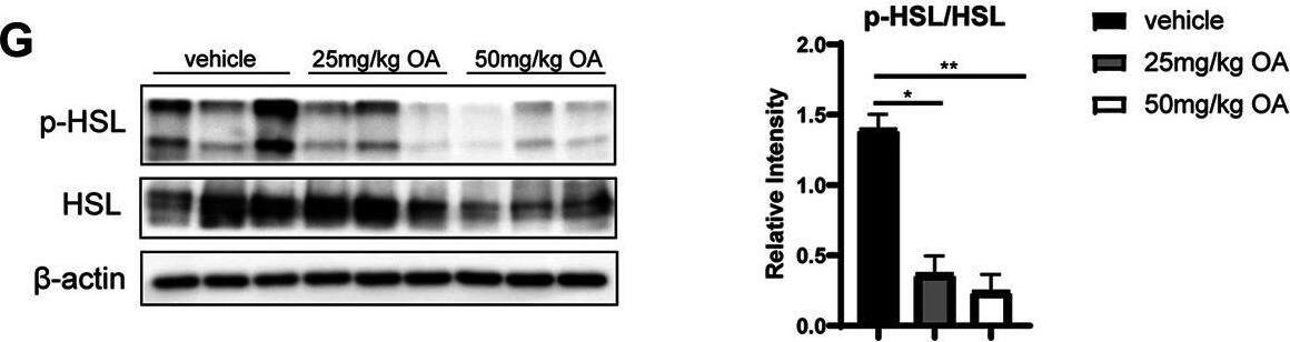 Hormone-sensitive Lipase/HSL [p Ser660] Antibody - Azide and BSA Free