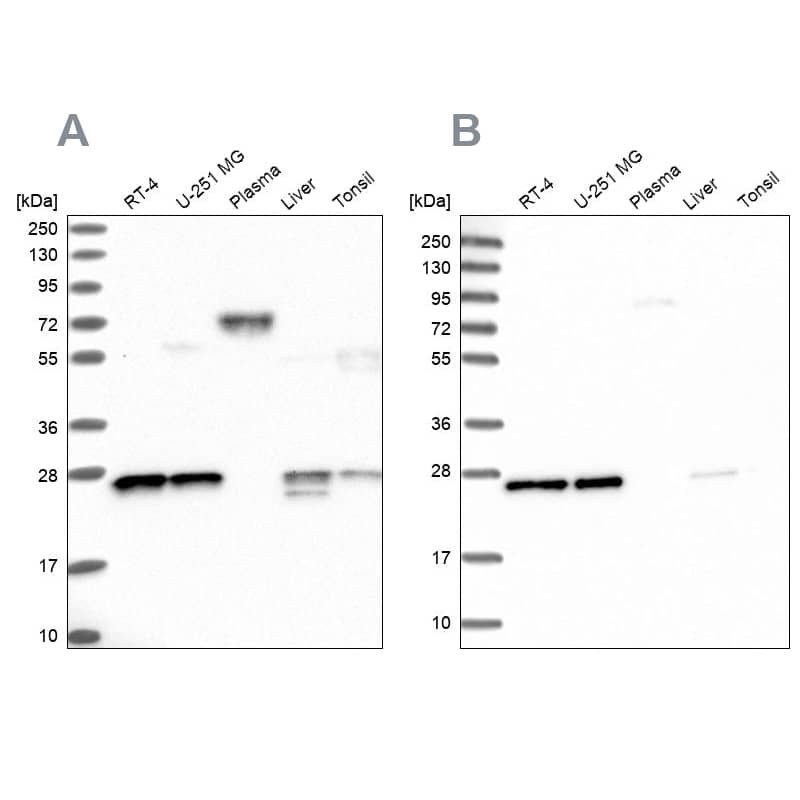 MESDC2 Antibody Western Blot: MESDC2 Antibody Antibody [NBP3-05518]