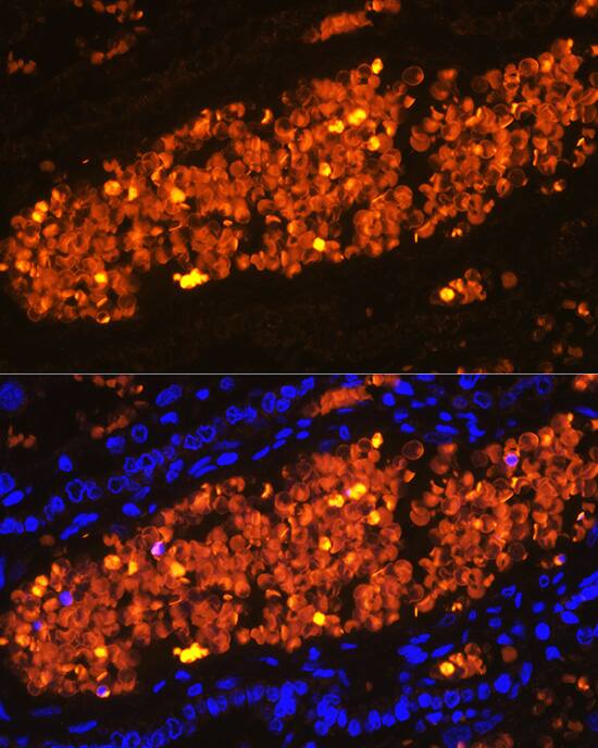 Hemoglobin A2 Antibody - BSA Free