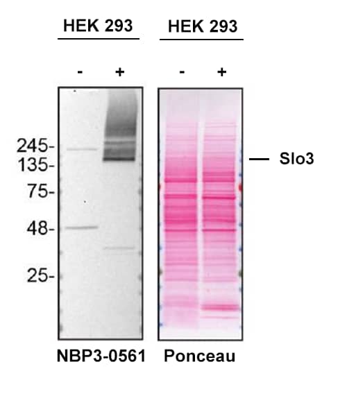 Western Blot Shows Human Slo3 Specificity Using Overexpression Cell Line.