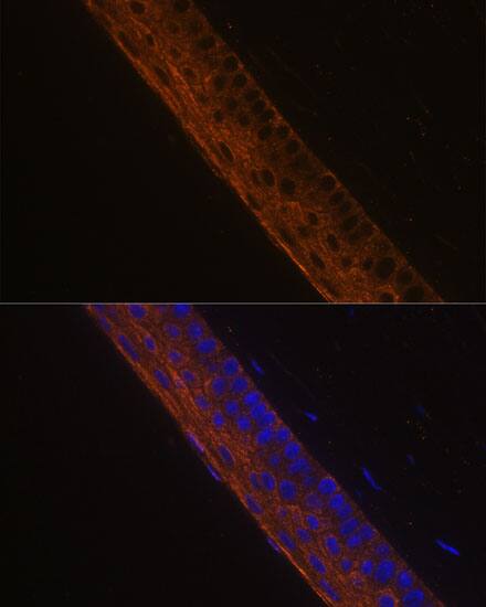 Myosin heavy chain 13 Antibody - Azide and BSA Free