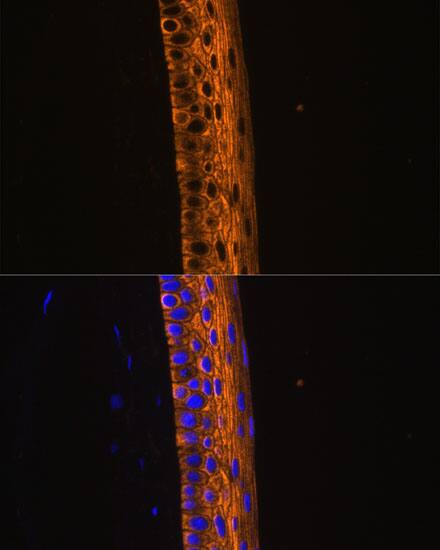Myosin heavy chain 13 Antibody - Azide and BSA Free