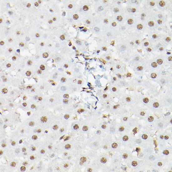 FOXO1A/3/4 Antibody - Azide and BSA Free