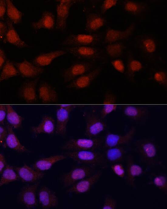 5-Methylcytidine Antibody - BSA Free