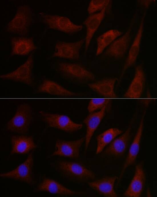 pan PKC Antibody - BSA Free