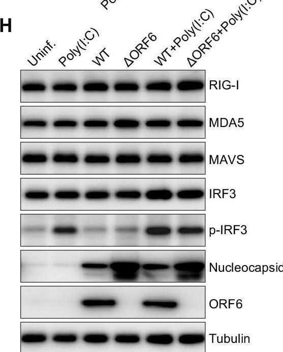 SARS-CoV-2 ORF6 Antibody - BSA Free