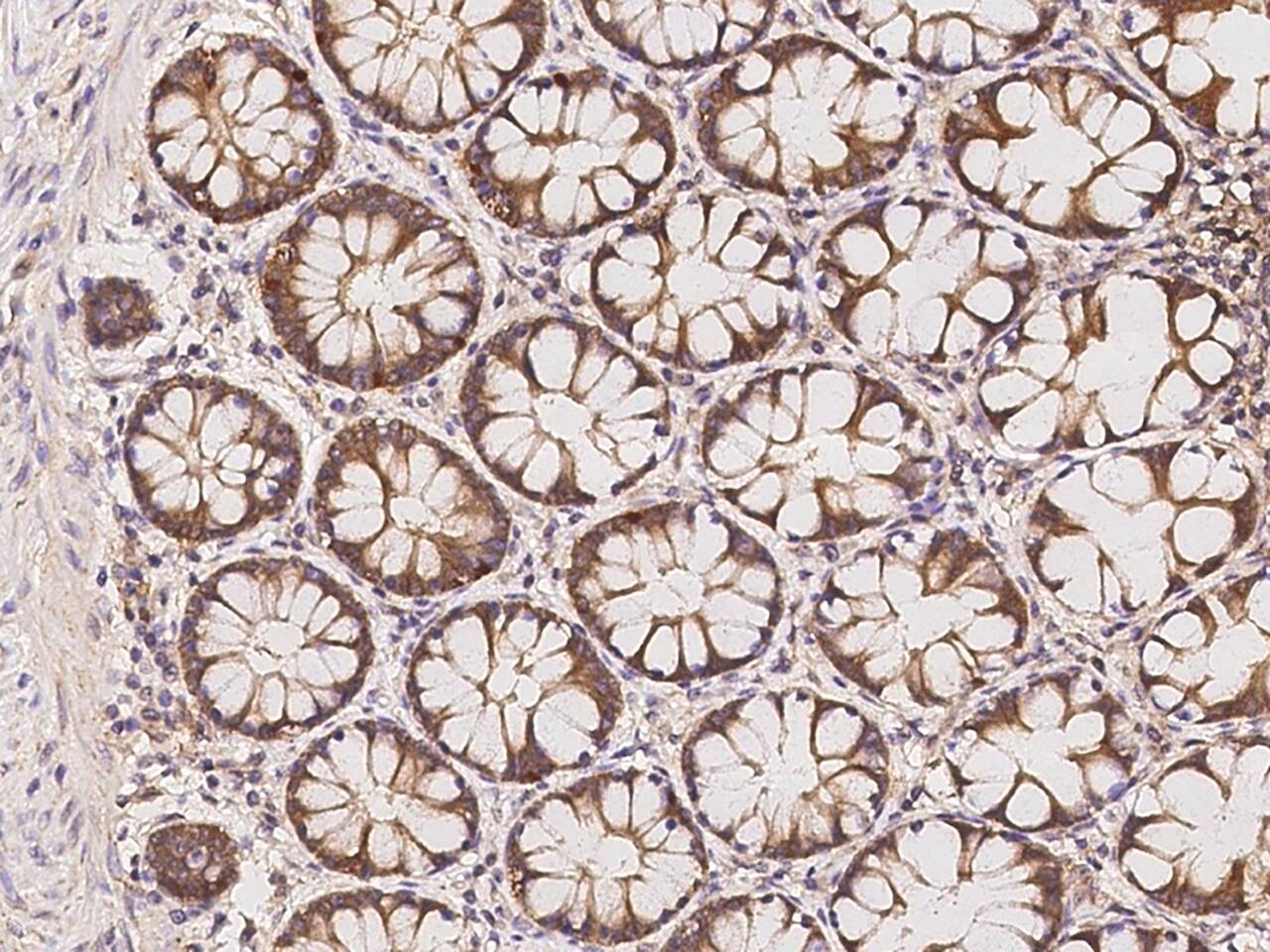 PHACTR4 Antibody - BSA Free