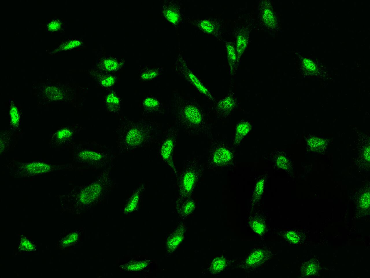 ADAMTSL4 Antibody - BSA Free