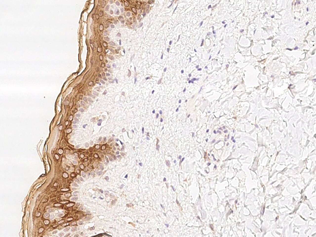 Basalin Antibody - BSA Free