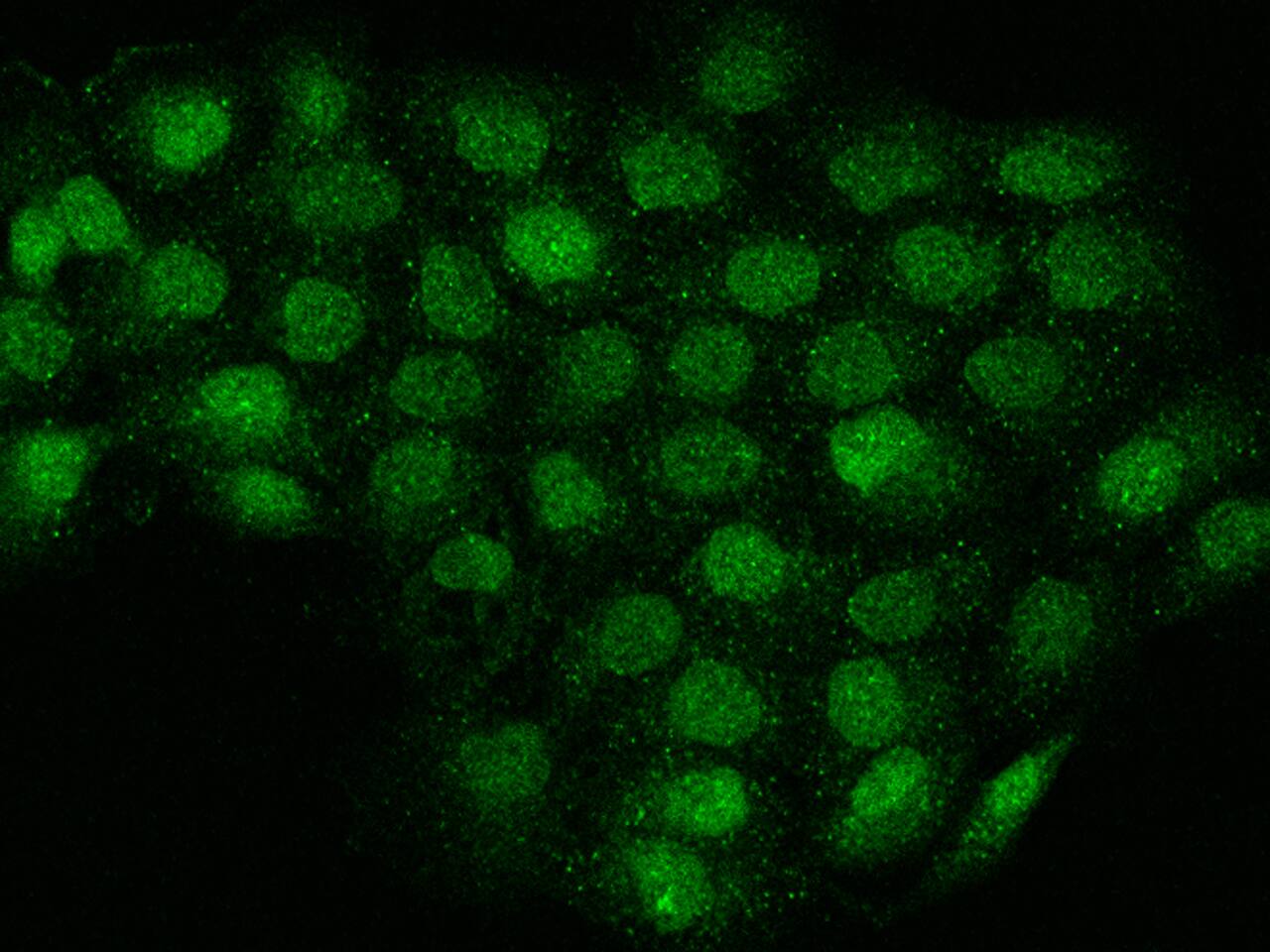 TMEM194A Antibody - BSA Free