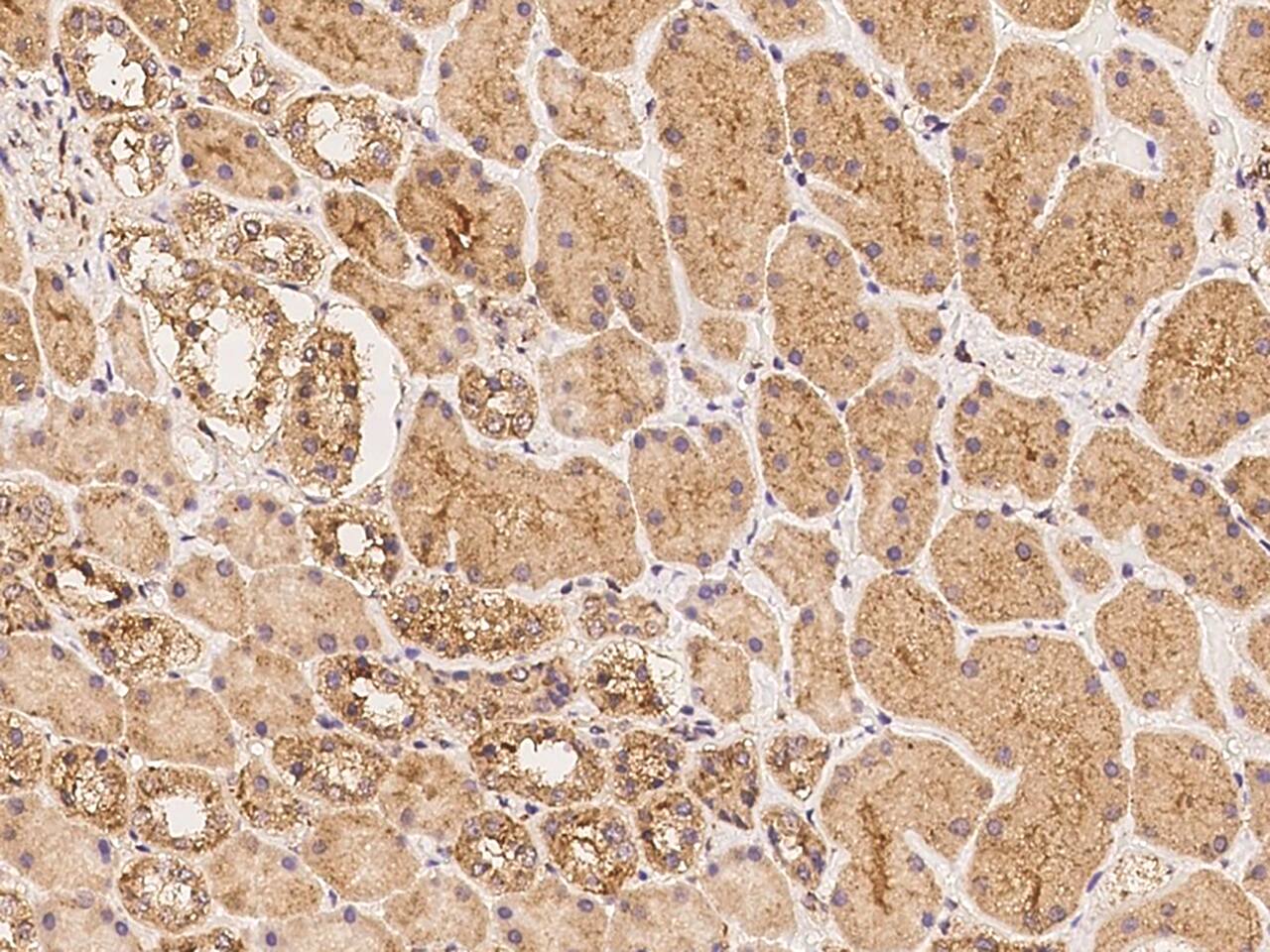 TMEM194A Antibody - BSA Free