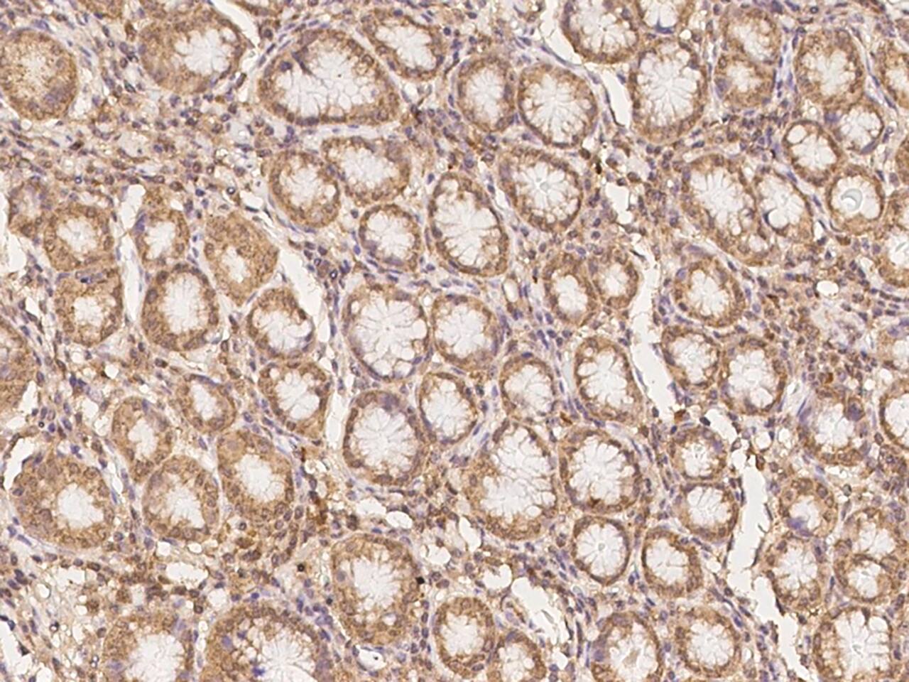 CLN6 Antibody - BSA Free