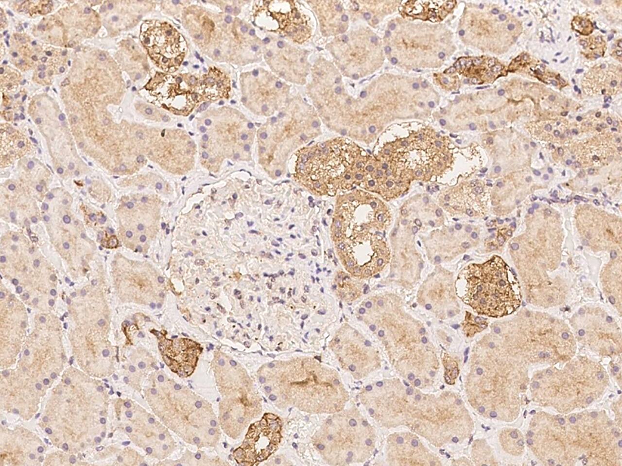 Ceruloplasmin Antibody - BSA Free