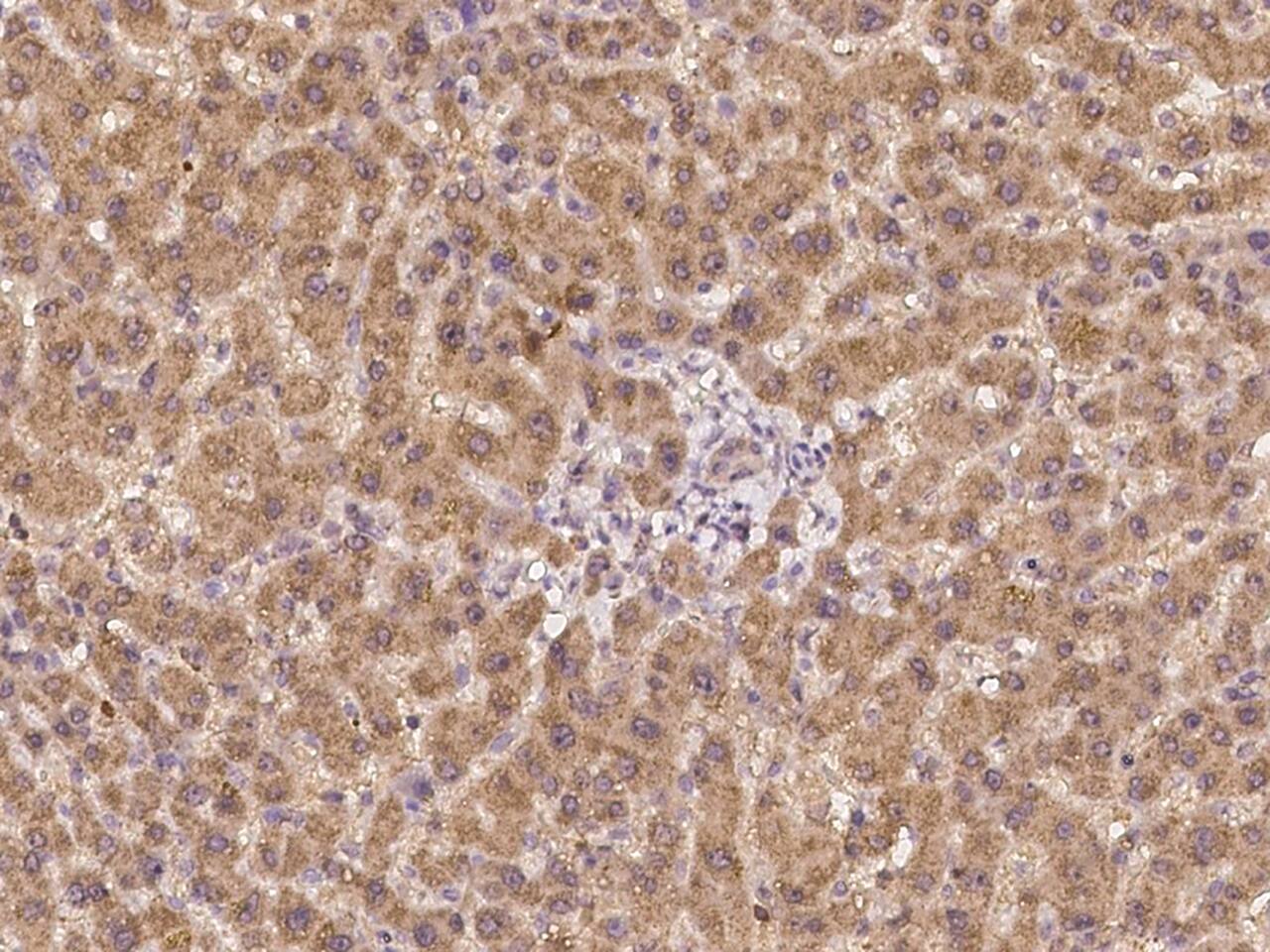 Ceruloplasmin Antibody - BSA Free