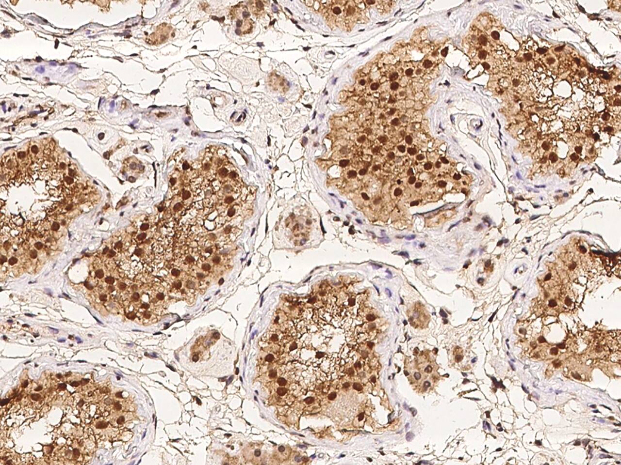 LEMD3 Antibody - BSA Free