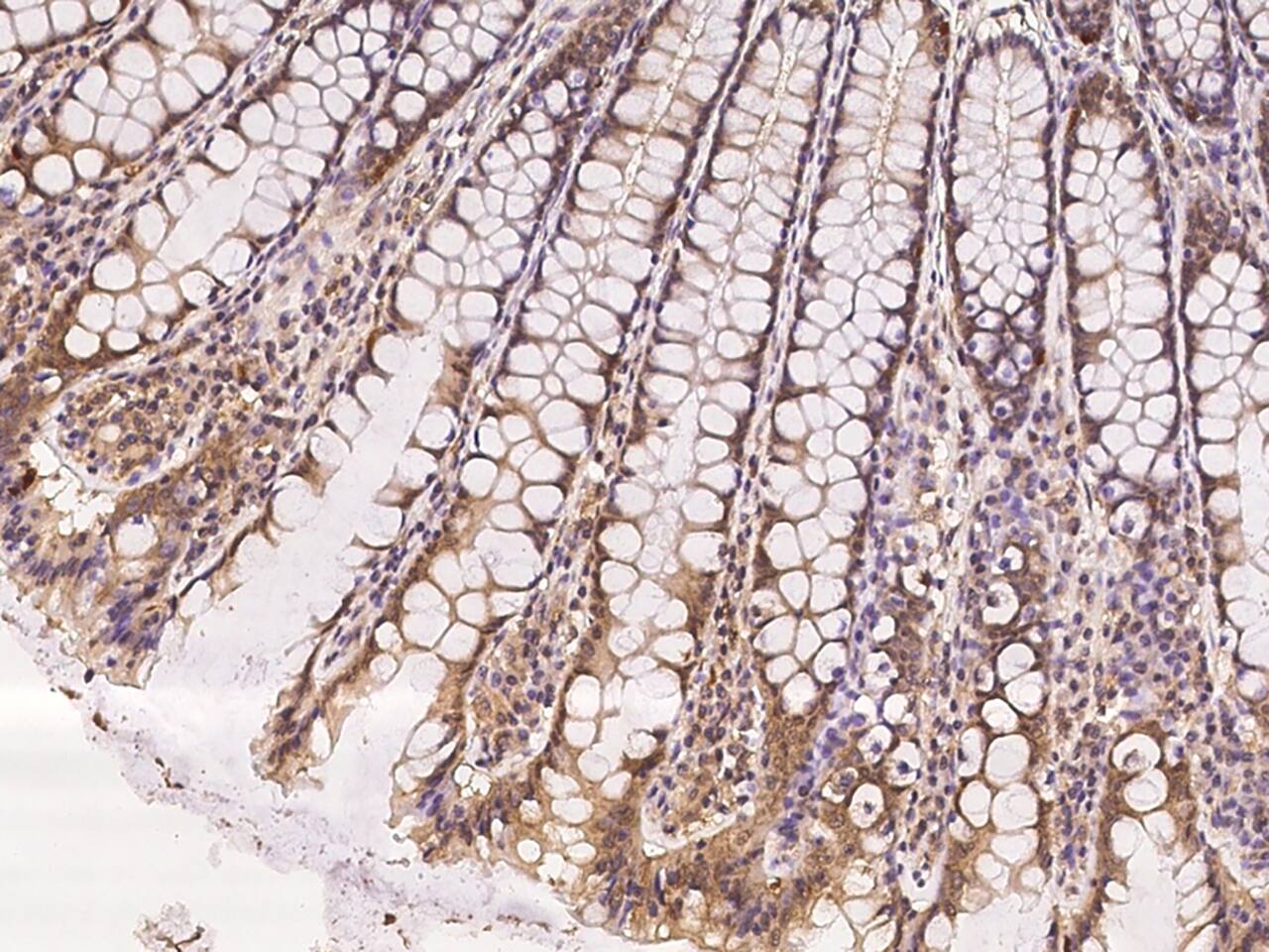 LEMD3 Antibody - BSA Free