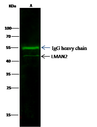 LMAN2 Antibody (02) - Azide and BSA Free