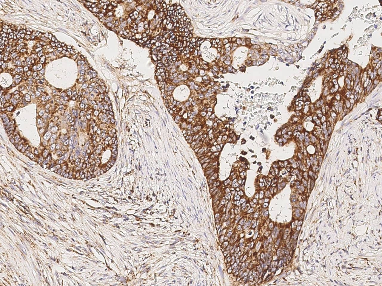 COX4-I1 Antibody - Azide and BSA Free