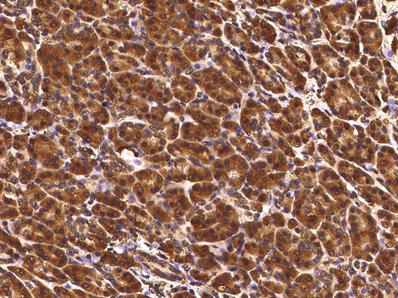 TCERG1L Antibody (05) - Azide and BSA Free