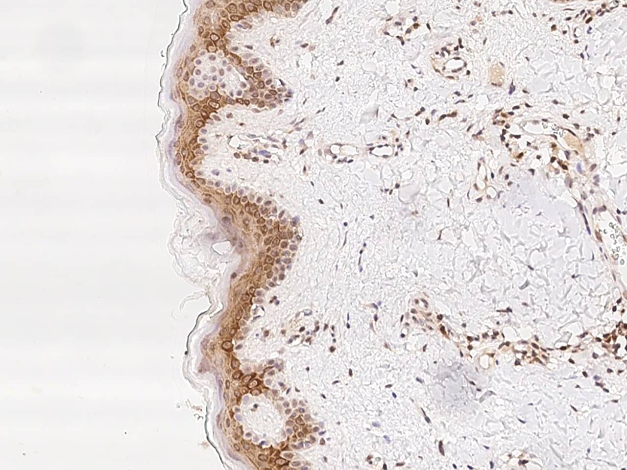 TMC2 Antibody - BSA Free