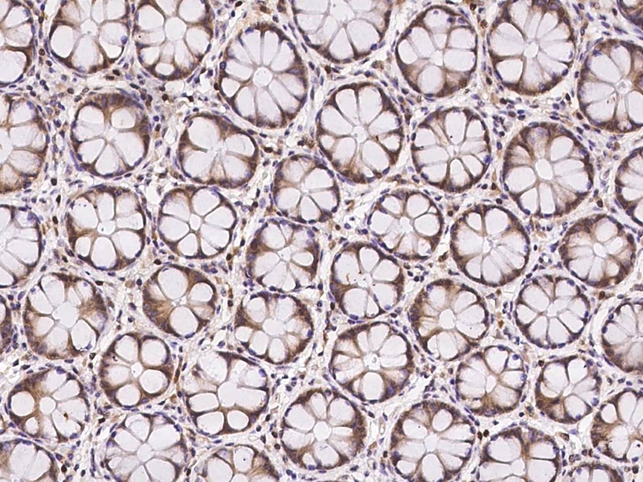 TMC2 Antibody - BSA Free